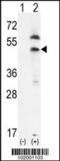 Platelet Derived Growth Factor Receptor Like antibody, 63-123, ProSci, Western Blot image 