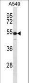 Keratin 7 antibody, LS-C165634, Lifespan Biosciences, Western Blot image 