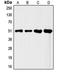 Fli-1 Proto-Oncogene, ETS Transcription Factor antibody, orb213939, Biorbyt, Western Blot image 