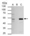 Estrogen Related Receptor Alpha antibody, GTX106233, GeneTex, Immunoprecipitation image 