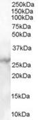 Mannose Binding Lectin 2 antibody, NB100-1502, Novus Biologicals, Western Blot image 