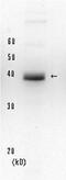 XPA, DNA Damage Recognition And Repair Factor antibody, 70-032, BioAcademia Inc, Western Blot image 