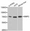 Matrix Metallopeptidase 2 antibody, LS-C334592, Lifespan Biosciences, Western Blot image 