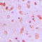 Zinc Finger DHHC-Type Containing 9 antibody, LS-C353431, Lifespan Biosciences, Immunohistochemistry paraffin image 