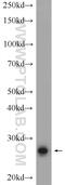 Ring Finger Protein 151 antibody, 24708-1-AP, Proteintech Group, Western Blot image 