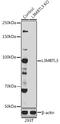 L3MBTL Histone Methyl-Lysine Binding Protein 3 antibody, GTX32696, GeneTex, Western Blot image 