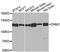 Dynamin 2 antibody, A0523, ABclonal Technology, Western Blot image 