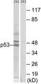 p53 antibody, TA326192, Origene, Western Blot image 