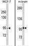 VPS53 Subunit Of GARP Complex antibody, AP18239PU-N, Origene, Western Blot image 