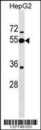Peptidase Inhibitor 16 antibody, 59-398, ProSci, Western Blot image 