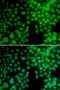 Vitamin D Receptor antibody, STJ26084, St John