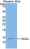 Vascular Endothelial Growth Factor D antibody, MBS2005258, MyBioSource, Western Blot image 