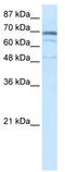 Zinc Finger Protein 614 antibody, TA337979, Origene, Western Blot image 