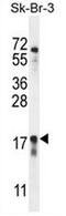 Chromosome 1 Open Reading Frame 115 antibody, AP50694PU-N, Origene, Western Blot image 