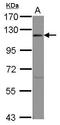 Eukaryotic Translation Initiation Factor 3 Subunit C antibody, GTX101801, GeneTex, Western Blot image 