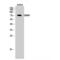 DM1 Protein Kinase antibody, LS-C383153, Lifespan Biosciences, Western Blot image 