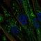 Cytochrome P450 19A1 antibody, NBP2-48998, Novus Biologicals, Immunofluorescence image 