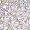 Kelch Like ECH Associated Protein 1 antibody, LS-C331712, Lifespan Biosciences, Immunohistochemistry paraffin image 