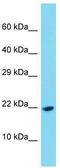 Platelet-derived growth factor C antibody, TA343169, Origene, Western Blot image 