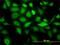 Keratin 20 antibody, H00054474-M01, Novus Biologicals, Immunocytochemistry image 