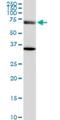 Exocyst Complex Component 7 antibody, H00023265-M05, Novus Biologicals, Western Blot image 