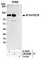 CD276 Molecule antibody, A304-368A, Bethyl Labs, Immunoprecipitation image 