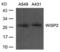 Cellular Communication Network Factor 5 antibody, PA5-49693, Invitrogen Antibodies, Western Blot image 