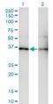 G Protein Subunit Beta 5 antibody, H00010681-M01, Novus Biologicals, Western Blot image 