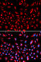 Claudin 11 antibody, STJ23156, St John