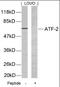 Activating Transcription Factor 2 antibody, orb87183, Biorbyt, Western Blot image 