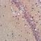 Dysferlin antibody, orb13379, Biorbyt, Immunohistochemistry paraffin image 