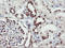 RNA Binding Protein, MRNA Processing Factor antibody, LS-C175184, Lifespan Biosciences, Immunohistochemistry paraffin image 