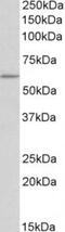 Tryptophan Hydroxylase 2 antibody, TA311592, Origene, Western Blot image 