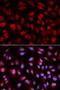 Polo Like Kinase 1 antibody, orb136097, Biorbyt, Immunofluorescence image 