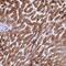 Retinol Dehydrogenase 16 antibody, PA5-58423, Invitrogen Antibodies, Immunohistochemistry paraffin image 