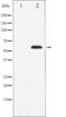 LCK Proto-Oncogene, Src Family Tyrosine Kinase antibody, abx012314, Abbexa, Western Blot image 