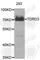 Tudor Domain Containing 3 antibody, A6000, ABclonal Technology, Western Blot image 