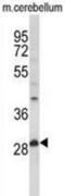 Palmitoyl-Protein Thioesterase 1 antibody, abx031626, Abbexa, Western Blot image 