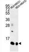 Cornifin-B antibody, AP54033PU-N, Origene, Western Blot image 