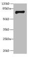 Gamma-Aminobutyric Acid Type A Receptor Alpha4 Subunit antibody, A50233-100, Epigentek, Western Blot image 