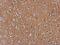 AXL Receptor Tyrosine Kinase antibody, GTX101345, GeneTex, Immunohistochemistry paraffin image 