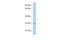 Progestin And AdipoQ Receptor Family Member 4 antibody, A17185, Boster Biological Technology, Western Blot image 