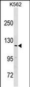 HECT And RLD Domain Containing E3 Ubiquitin Protein Ligase 3 antibody, PA5-49212, Invitrogen Antibodies, Western Blot image 