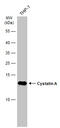 Cystatin A antibody, GTX634198, GeneTex, Western Blot image 