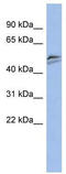 Small Nuclear RNA Activating Complex Polypeptide 3 antibody, TA334779, Origene, Western Blot image 