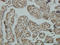 Non-SMC Condensin I Complex Subunit D2 antibody, LS-C133608, Lifespan Biosciences, Immunohistochemistry paraffin image 