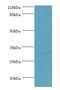 Kallikrein Related Peptidase 5 antibody, A51429-100, Epigentek, Western Blot image 