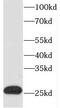 Ecotropic Viral Integration Site 2A antibody, FNab02884, FineTest, Western Blot image 