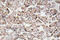 Insulin Like Growth Factor 1 antibody, LS-C199896, Lifespan Biosciences, Immunohistochemistry paraffin image 