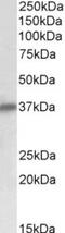 Sarcoglycan Delta antibody, TA311125, Origene, Western Blot image 